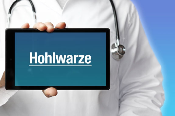 Schlupfwarzen Leverkusen